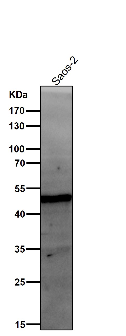 1 - Anti-FOXA2/Hnf3B Rabbit Monoclonal Antibody ABO13760