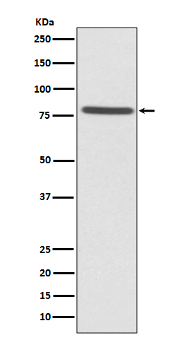 1 - Anti-Ezrin Rabbit Monoclonal Antibody ABO13761