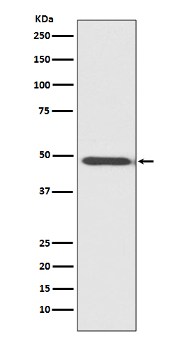 1 - Anti-MyoD1/Myod Rabbit Monoclonal Antibody ABO13762