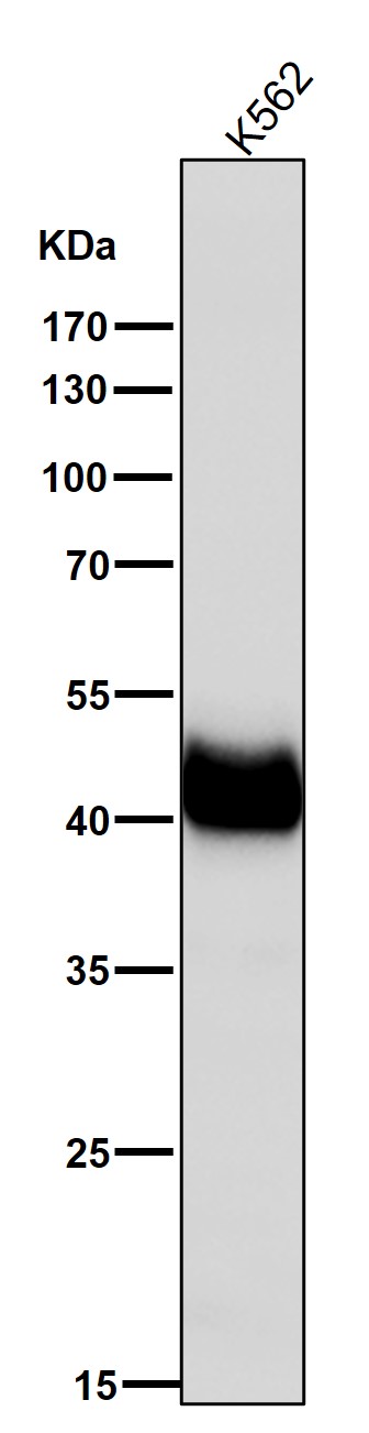 1 - Anti-FABP1/L Fabp Rabbit Monoclonal Antibody ABO13763