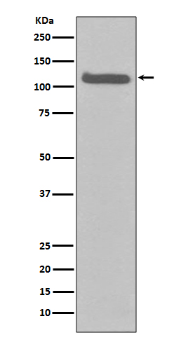 1 - Anti-FGFR3 Rabbit Monoclonal Antibody ABO13764