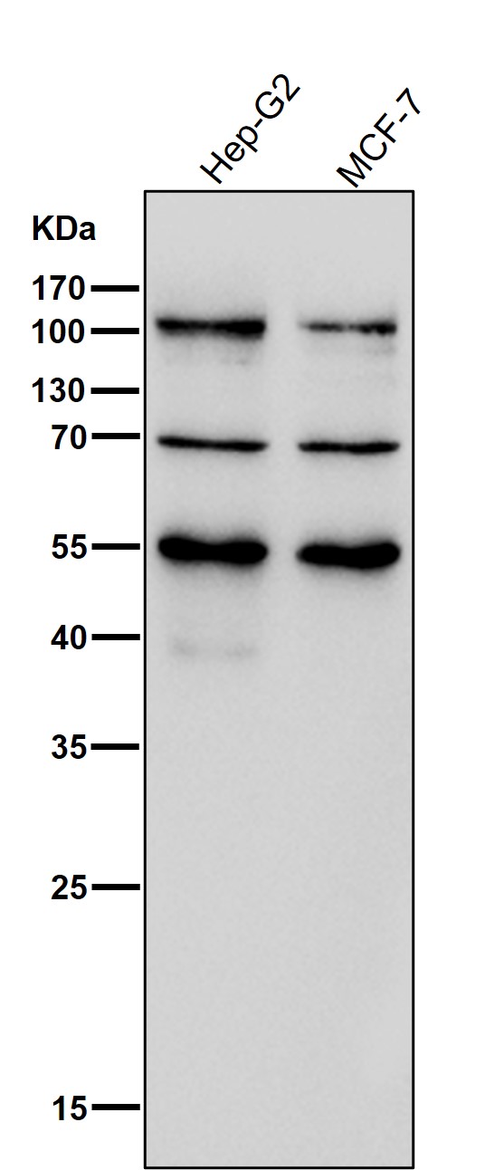 1 - Anti-FGFR3 Rabbit Monoclonal Antibody ABO13764