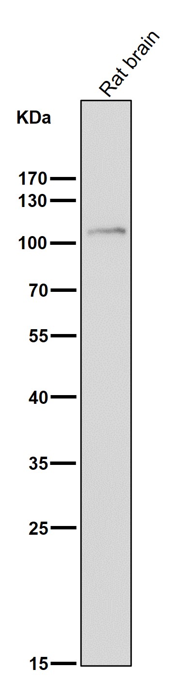 1 - Anti-FGFR3 Rabbit Monoclonal Antibody ABO13764