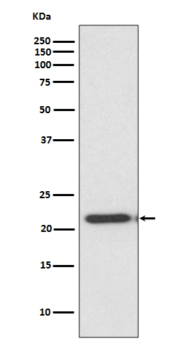1 - Anti-TIMP2 Rabbit Monoclonal Antibody ABO13765