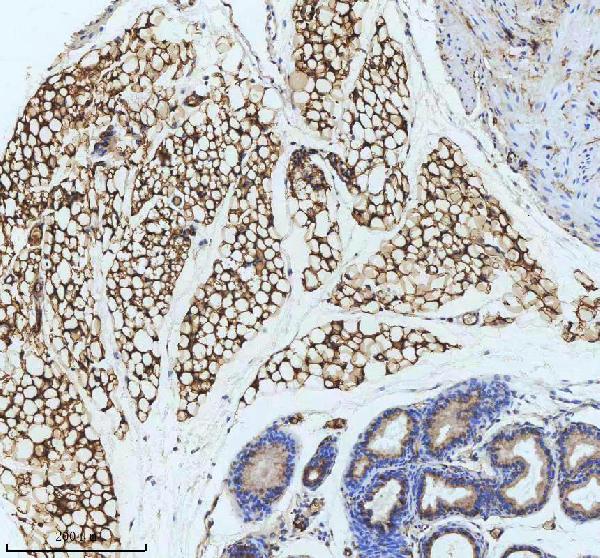 2 - Anti-FABP4/A Fabp Rabbit Monoclonal Antibody ABO13768