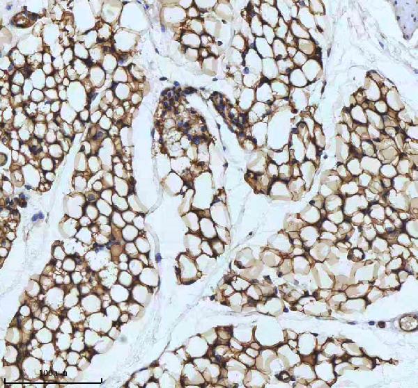 2 - Anti-FABP4/A Fabp Rabbit Monoclonal Antibody ABO13768