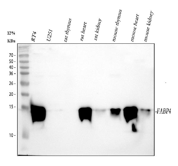 1 - Anti-FABP4/A Fabp Rabbit Monoclonal Antibody ABO13768