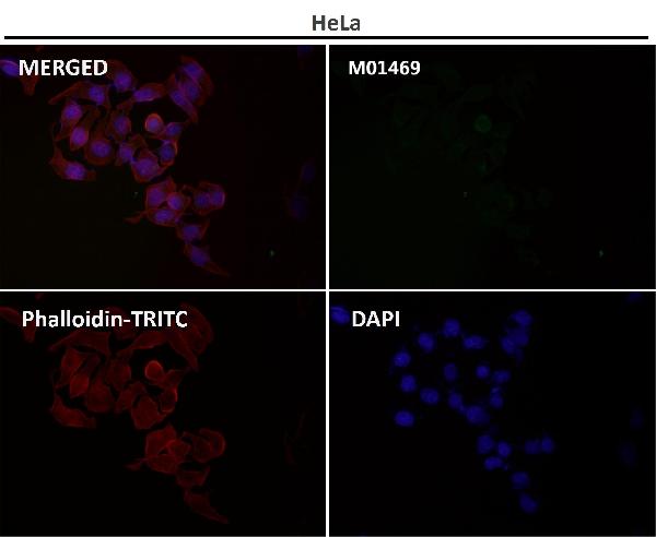1 - Anti-BNIP3 Rabbit Monoclonal Antibody ABO13770