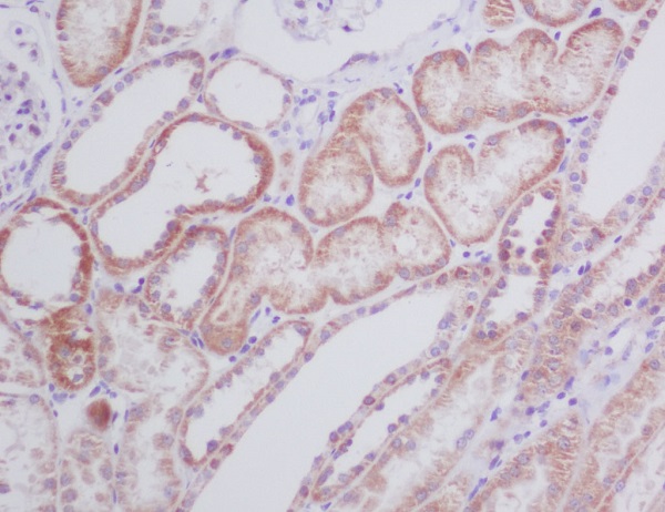 2 - Anti-BNIP3 Rabbit Monoclonal Antibody ABO13770