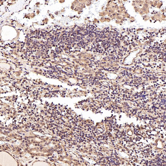 2 - Anti-BNIP3 Rabbit Monoclonal Antibody ABO13770