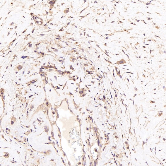 2 - Anti-BNIP3 Rabbit Monoclonal Antibody ABO13770