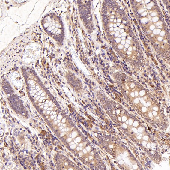 2 - Anti-BNIP3 Rabbit Monoclonal Antibody ABO13770