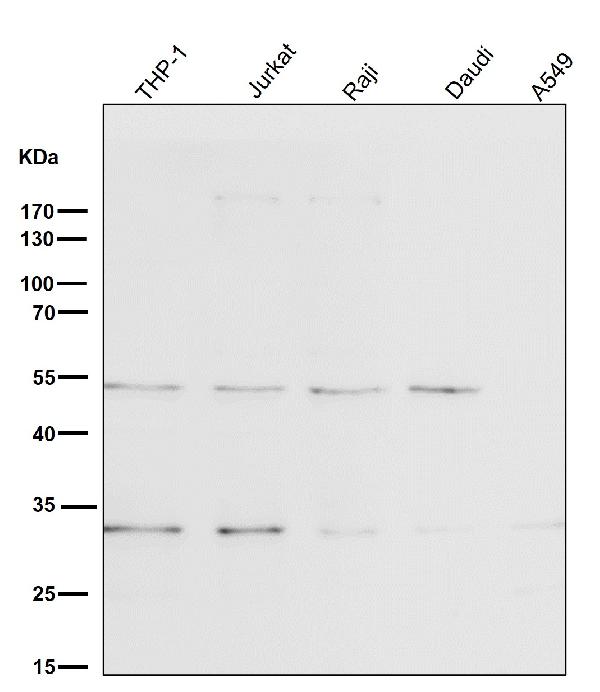1 - Anti-BNIP3 Rabbit Monoclonal Antibody ABO13770