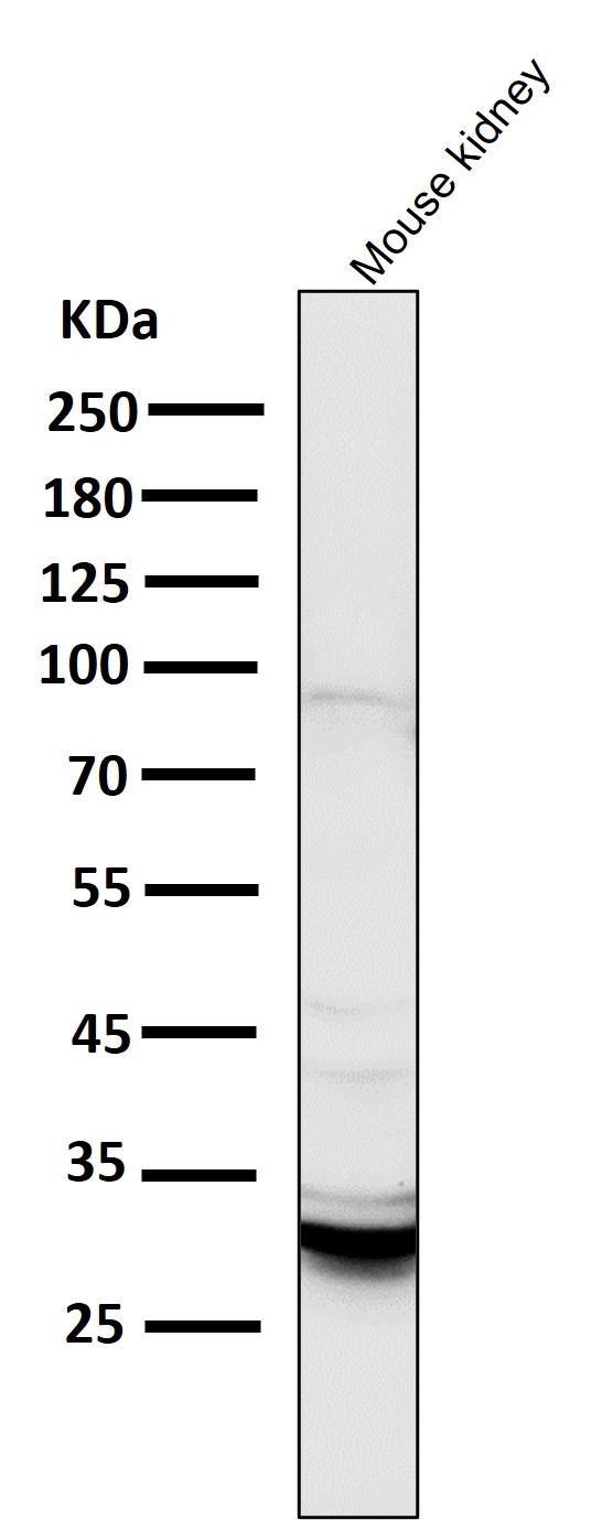 1 - Anti-BNIP3 Rabbit Monoclonal Antibody ABO13770