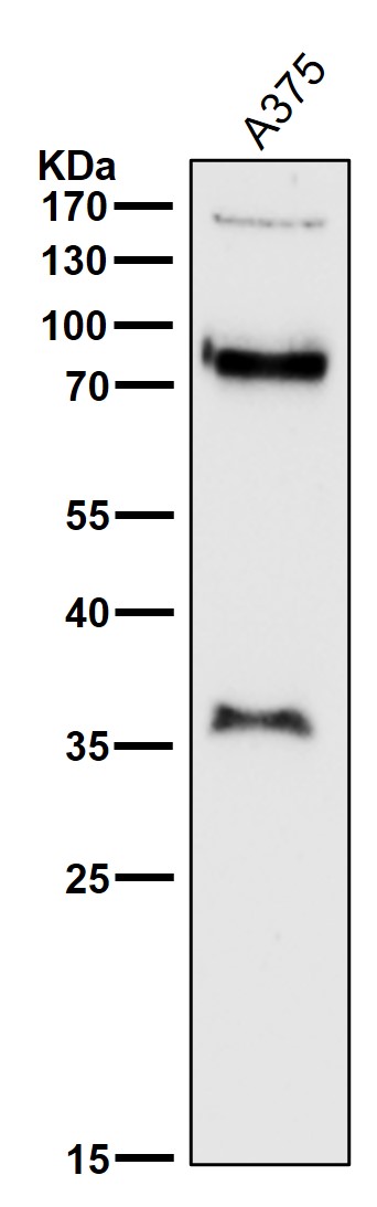 1 - Anti-L1CAM Rabbit Monoclonal Antibody ABO13771