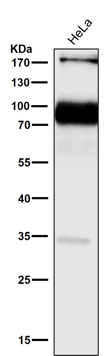 1 - Anti-L1CAM Rabbit Monoclonal Antibody ABO13771