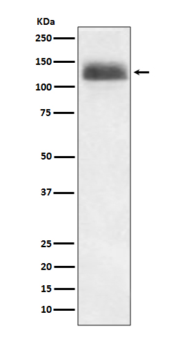 1 - Anti-NFAT1 NFATC2 Rabbit Monoclonal Antibody ABO13772