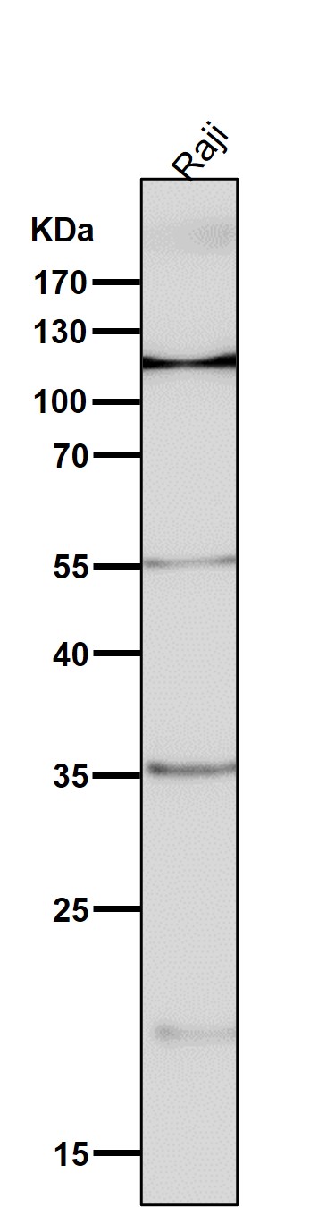 1 - Anti-NFAT1 NFATC2 Rabbit Monoclonal Antibody ABO13772