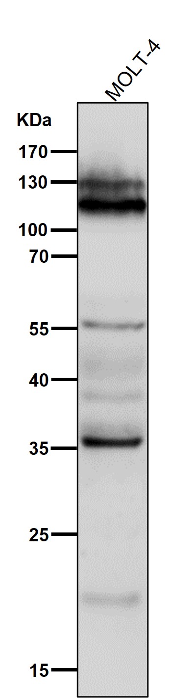 1 - Anti-NFAT1 NFATC2 Rabbit Monoclonal Antibody ABO13772