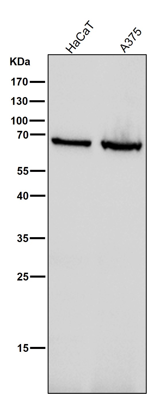 1 - Anti-GAD67 GAD1 Rabbit Monoclonal Antibody ABO13773