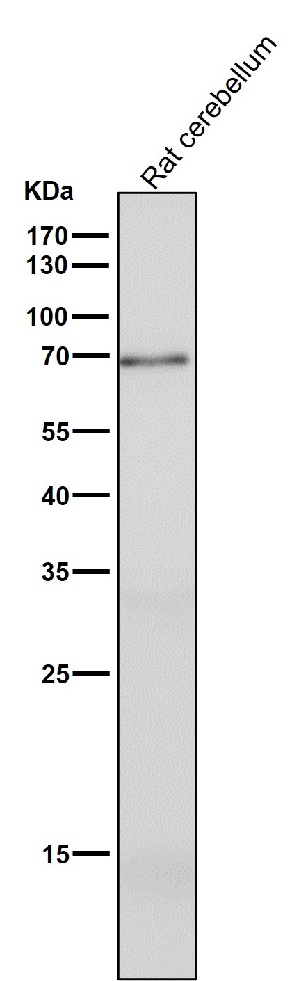 1 - Anti-GAD67 GAD1 Rabbit Monoclonal Antibody ABO13773