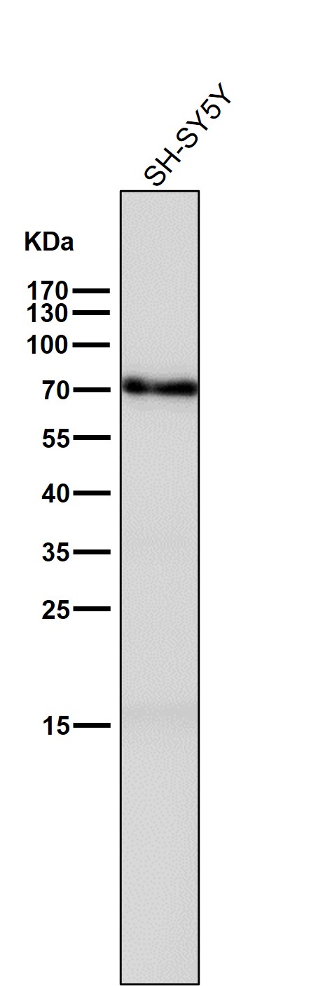 1 - Anti-GAD67 GAD1 Rabbit Monoclonal Antibody ABO13773