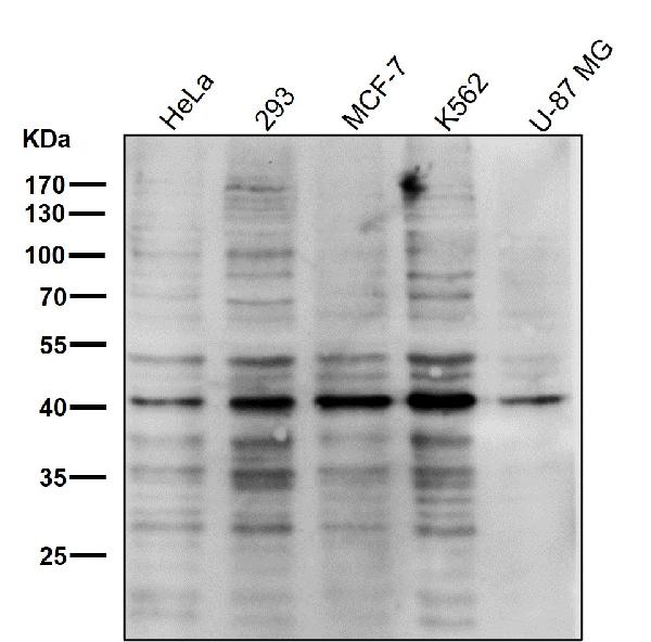1 - Anti-PRMT1 Rabbit Monoclonal Antibody ABO13775