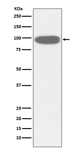 1 - Anti-GRP94 HSP90B1 Rabbit Monoclonal Antibody ABO13777