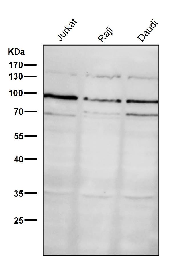 1 - Anti-GRP94 HSP90B1 Rabbit Monoclonal Antibody ABO13777