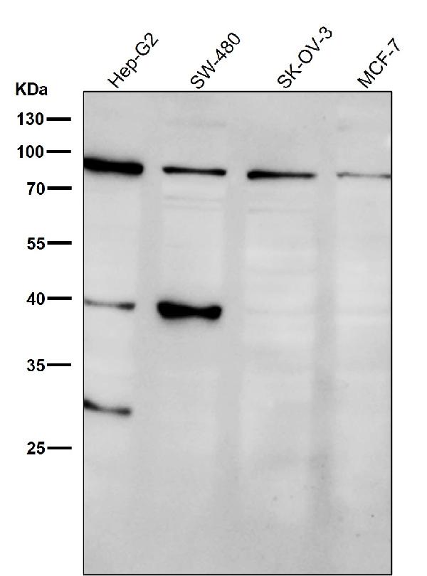 1 - Anti-GRP94 HSP90B1 Rabbit Monoclonal Antibody ABO13777