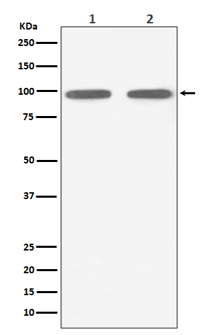 1 - Anti-FGFR3 Rabbit Monoclonal Antibody ABO13779
