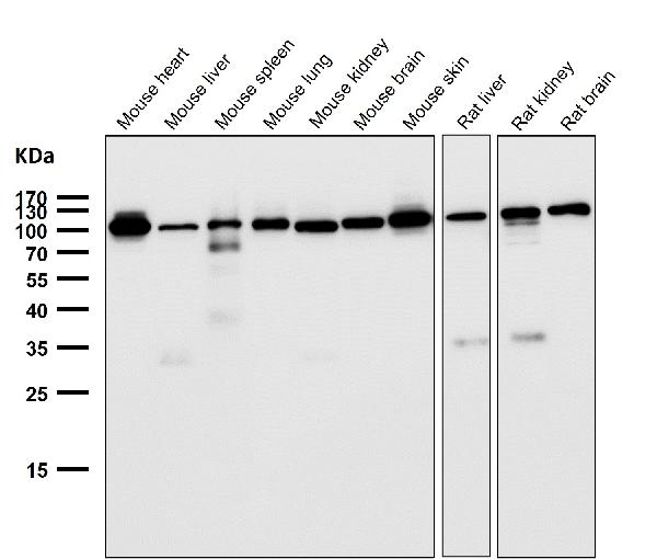1 - Anti-FGFR3 Rabbit Monoclonal Antibody ABO13779