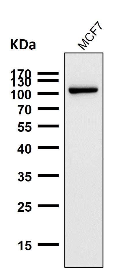 1 - Anti-FGFR3 Rabbit Monoclonal Antibody ABO13779