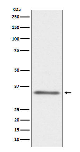 1 - Anti-CD40L CD40LG Rabbit Monoclonal Antibody ABO13780