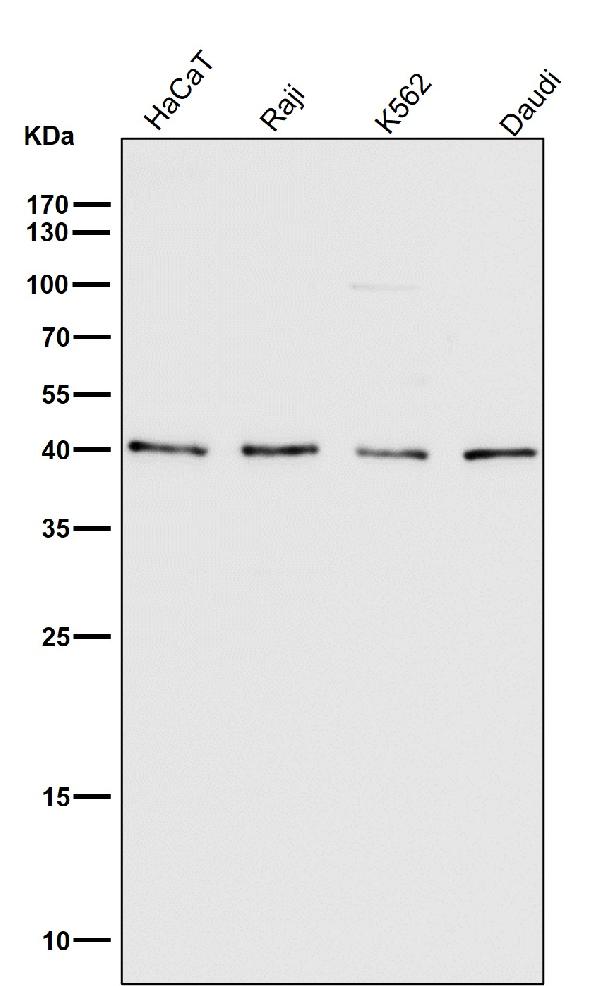 1 - Anti-CD40L CD40LG Rabbit Monoclonal Antibody ABO13780