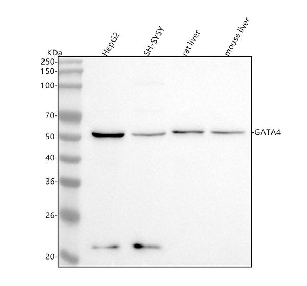 1 - Anti-GATA4 Rabbit Monoclonal Antibody ABO13781