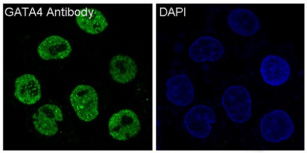 3 - Anti-GATA4 Rabbit Monoclonal Antibody ABO13781