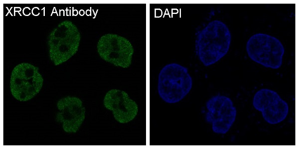3 - Anti-XRCC1 Rabbit Monoclonal Antibody ABO13783