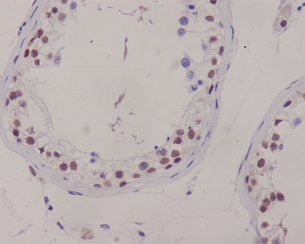 2 - Anti-XRCC1 Rabbit Monoclonal Antibody ABO13783