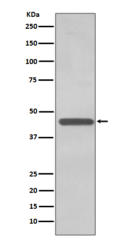 1 - Anti-TDP43 TARDBP Rabbit Monoclonal Antibody ABO13784