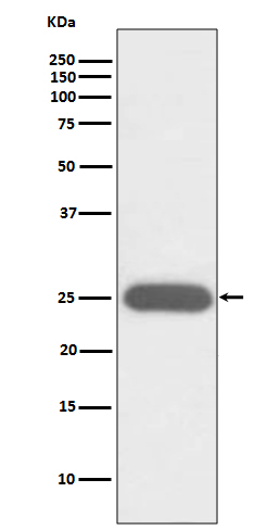 1 - Anti-G-CSF CSF3 Rabbit Monoclonal Antibody ABO13785
