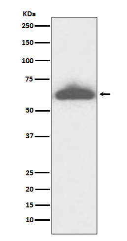 1 - Anti-RPE65 Rabbit Monoclonal Antibody ABO13786