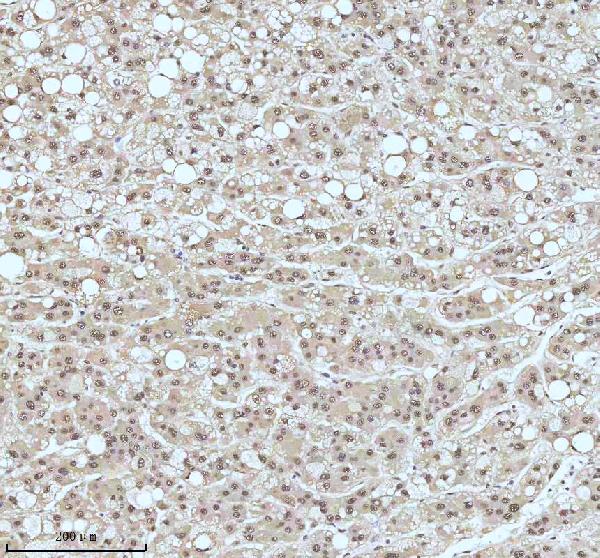 2 - Anti-53BP1 TP53BP1 Rabbit Monoclonal Antibody ABO13787