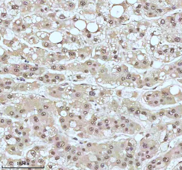 2 - Anti-53BP1 TP53BP1 Rabbit Monoclonal Antibody ABO13787