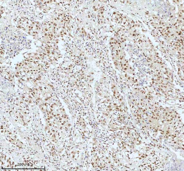 2 - Anti-53BP1 TP53BP1 Rabbit Monoclonal Antibody ABO13787
