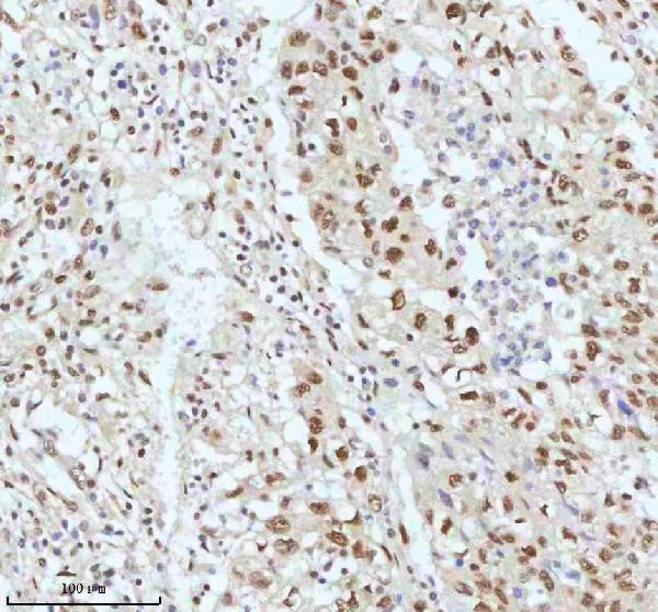 2 - Anti-53BP1 TP53BP1 Rabbit Monoclonal Antibody ABO13787