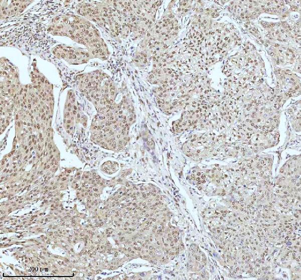 2 - Anti-53BP1 TP53BP1 Rabbit Monoclonal Antibody ABO13787