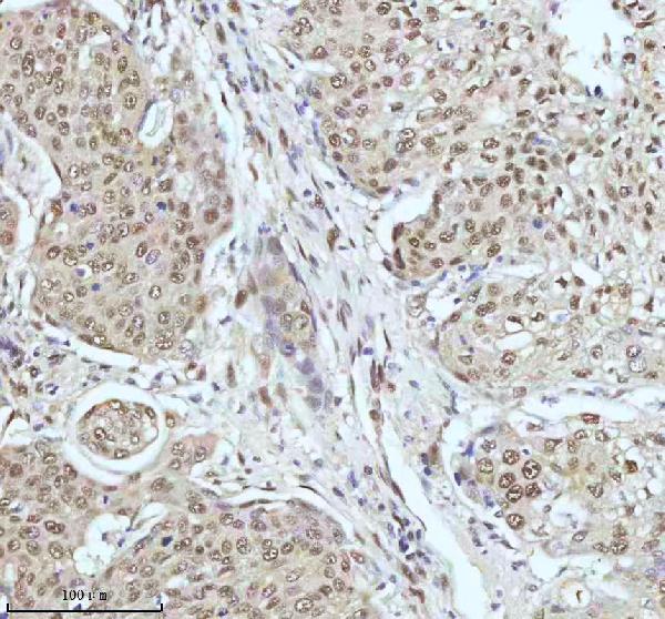 2 - Anti-53BP1 TP53BP1 Rabbit Monoclonal Antibody ABO13787