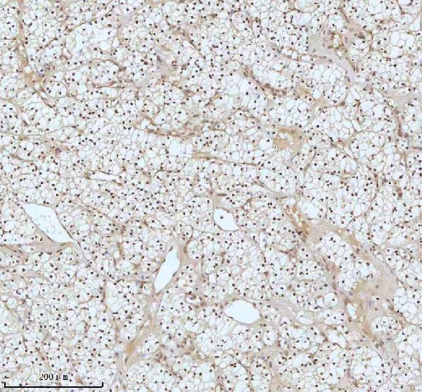2 - Anti-53BP1 TP53BP1 Rabbit Monoclonal Antibody ABO13787