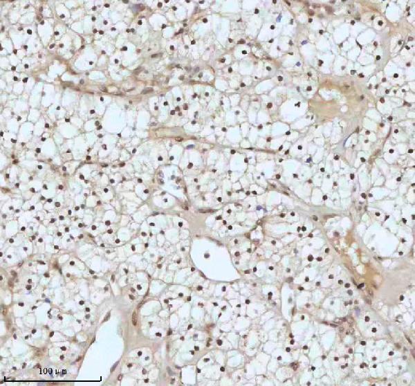 2 - Anti-53BP1 TP53BP1 Rabbit Monoclonal Antibody ABO13787
